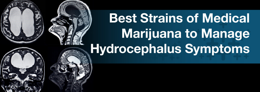 Best Strains of Medical Marijuana to Manage Hydrocephalus Symptoms