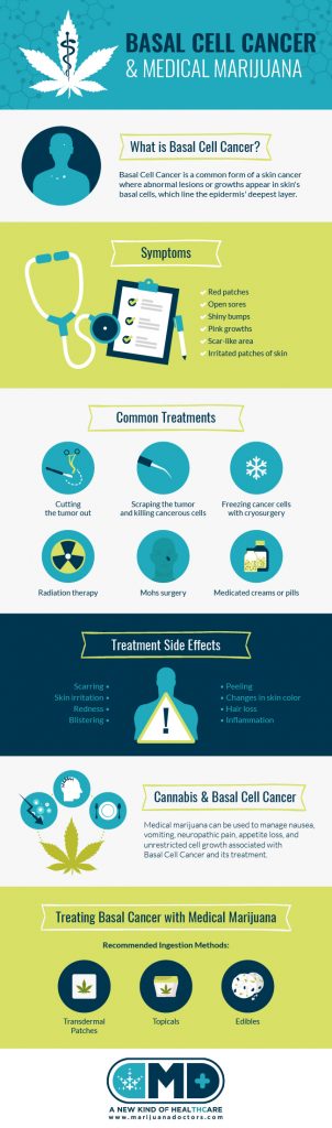 Basal Cell Cancer Treatment with Medical Marijuana?