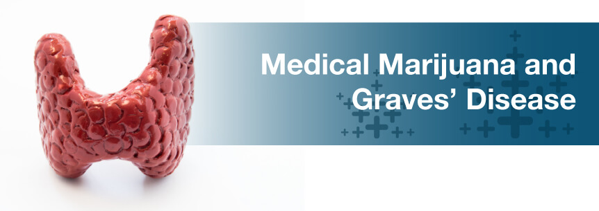 Graves’ Disease