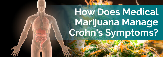 How Does Medical Marijuana Manage Crohn’s Symptoms? – Marijuana Doctors