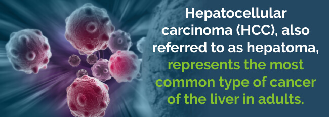 hcc liver cancer