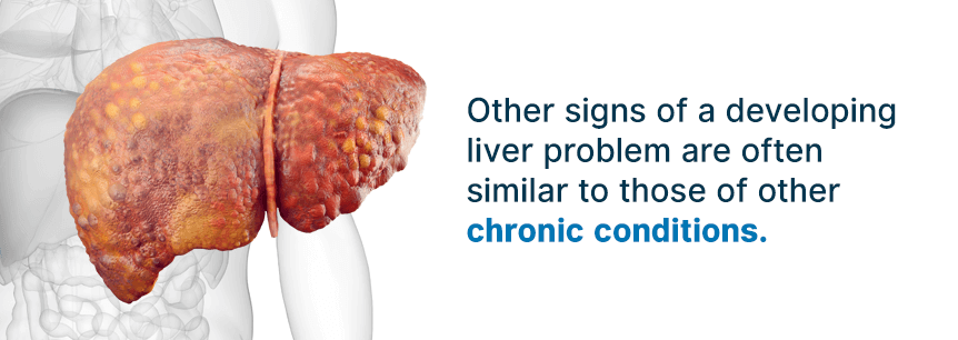 symptoms of liver disease