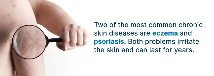 types of skin disease