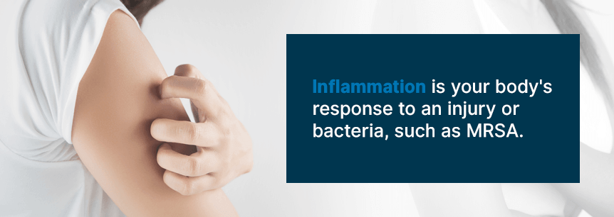 inflammation and swelling