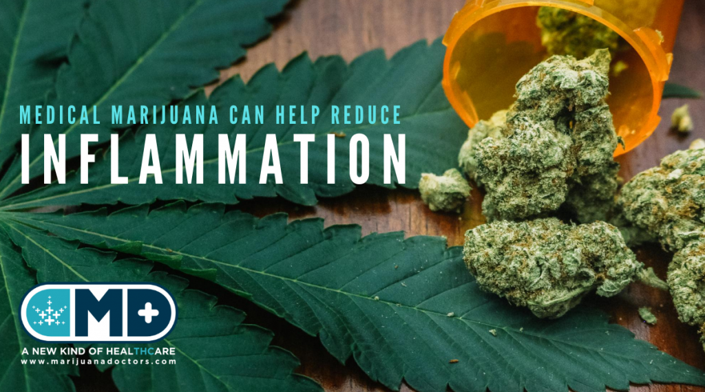 medical-marijuana-doctors-inflammation-1024x570